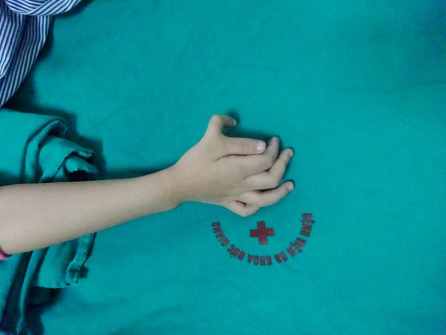 Bệnh viện đa khoa Đức Giang: Cắt ngón tay thừa, tạo hình chuyển gân cho trẻ 5 tuổi