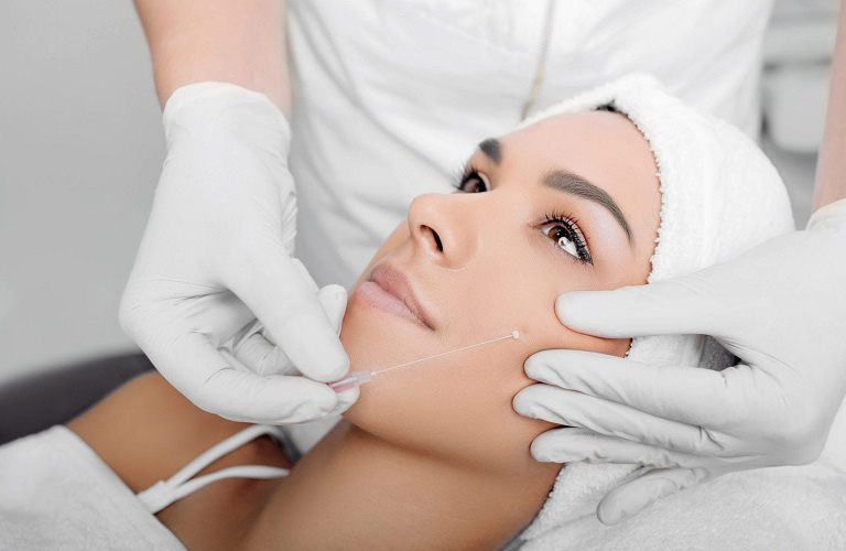 Cấy chỉ điều trị liệt mặt