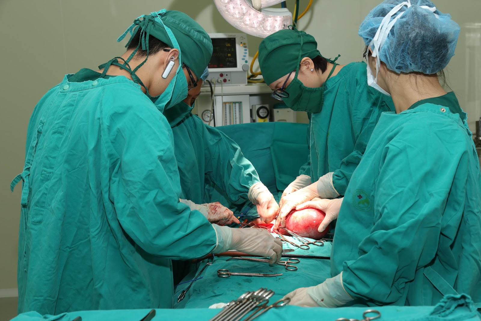 Phẫu thuật khối U “khủng” to như mang bầu 8 tháng