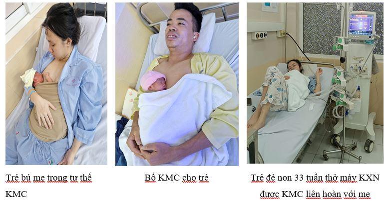 Tổng kết thực hiện Kangaroo (KMC) cho trẻ sinh non tại Bệnh viện đa khoa Đức Giang